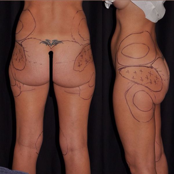 Le Spa Plastic Surgery