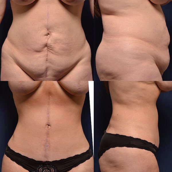 Le Spa Plastic Surgery