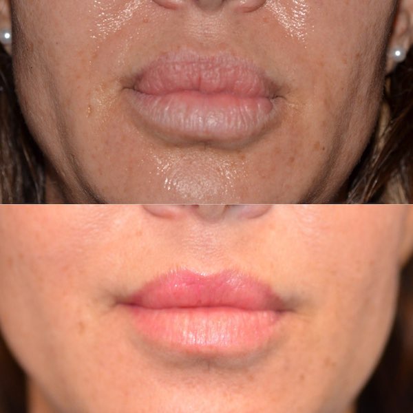 Le Spa Plastic Surgery