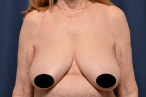 Le Spa Plastic Surgery Before and After Photos