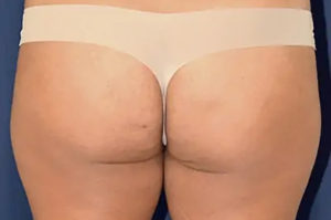 Le Spa Plastic Surgery Before and After Photos