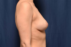 Le Spa Plastic Surgery Before and After Photos