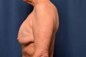 Le Spa Plastic Surgery Before and After Photos
