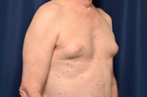 Le Spa Plastic Surgery Before and After Photos