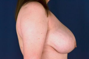 Le Spa Plastic Surgery Before and After Photos