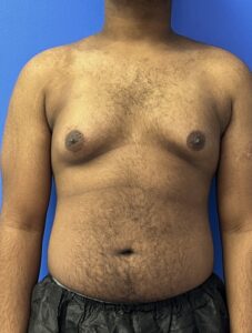Le Spa Plastic Surgery Before and After Photos