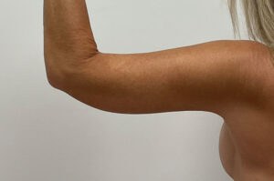 Le Spa Plastic Surgery Before and After Photos