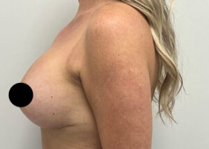 Le Spa Plastic Surgery Before and After Photos