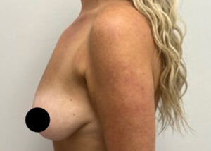Le Spa Plastic Surgery Before and After Photos