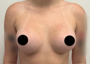 Le Spa Plastic Surgery Before and After Photos
