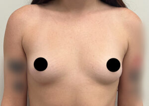 Le Spa Plastic Surgery Before and After Photos