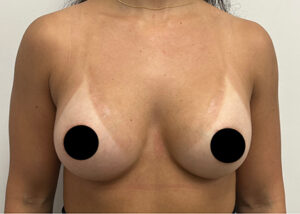 Le Spa Plastic Surgery Before and After Photos