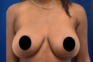 Le Spa Plastic Surgery Before and After Photos