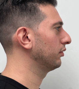 Le Spa Plastic Surgery Before and After Photos